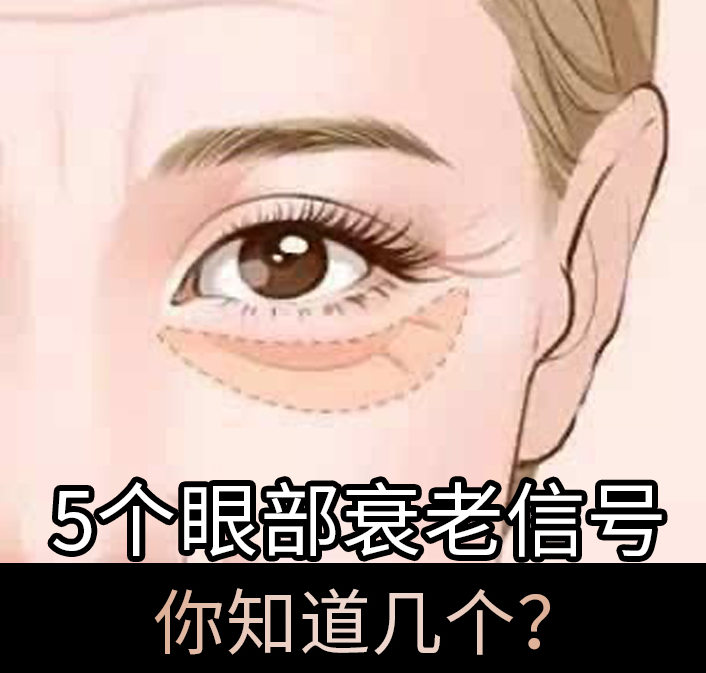 5個眼部衰老信號，你知道幾個？