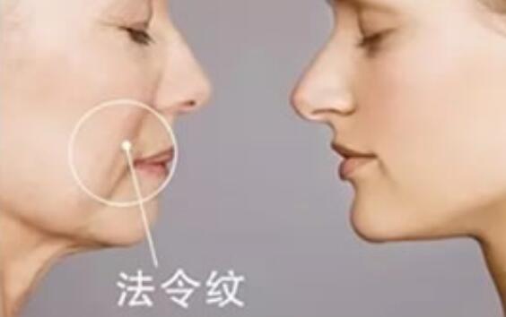 改善法令紋美容儀：科技創(chuàng)新，讓你告別歲月痕跡！