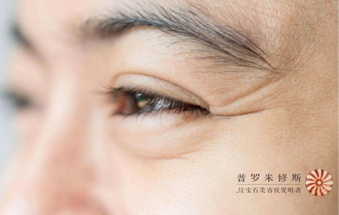 烙鐵們，你的魚(yú)尾紋真的需要熨一下！