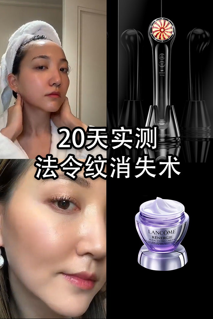 20天實測，法令紋消失術！射頻美容儀CP推薦